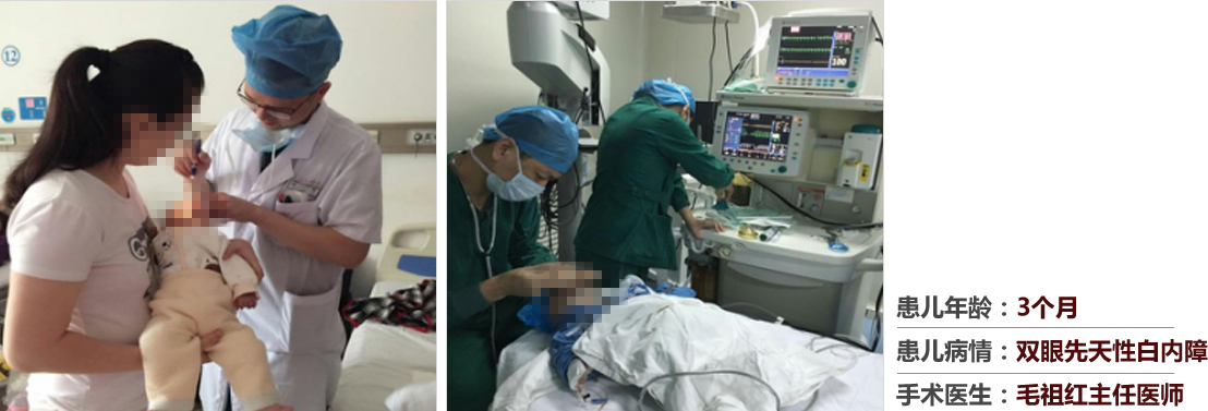 患兒年齡：3個月，患兒病情：雙眼先天性白內(nèi)障，手術(shù)醫(yī)生：毛祖紅主任醫(yī)師