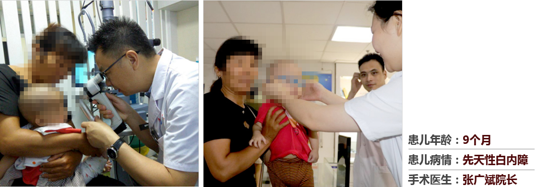 患兒年齡：9個月，患兒病情：先天性白內(nèi)障，手術(shù)醫(yī)生：張廣斌院長