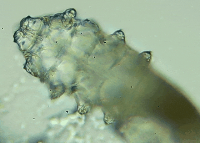 睫毛上驚現(xiàn)80只螨蟲！別揉了，快自查下你的眼睛有沒有......