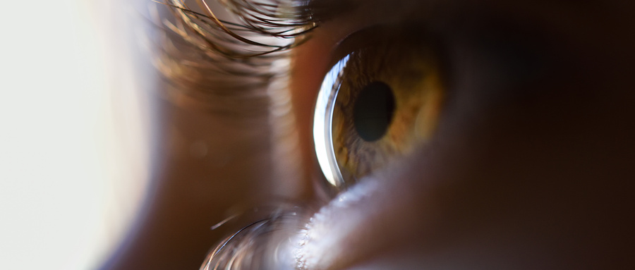 白內(nèi)障手術